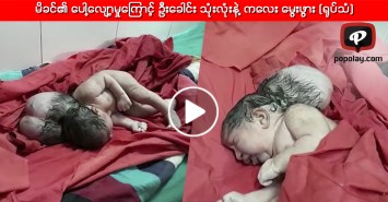မိခင္၏ ေပါ့ေလ်ာ့မႈေၾကာင့္ ဦးေခါင္း သုံးလုံးနဲ႔ ကေလး ေမြးဖြား (႐ုပ္သံ)